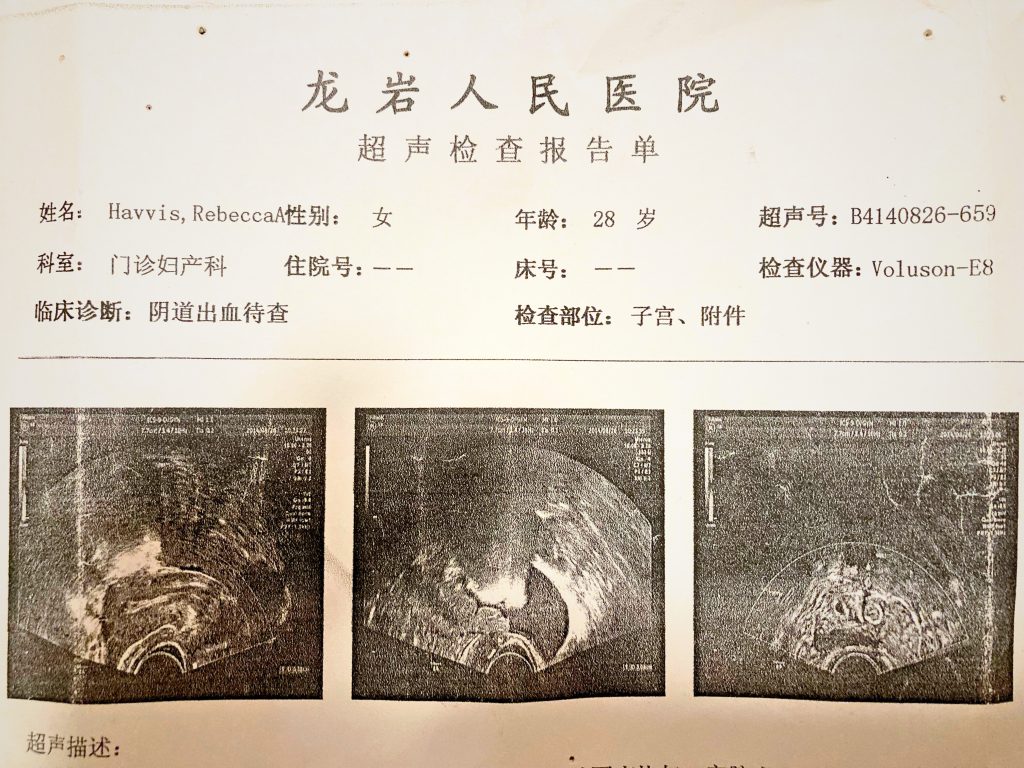 Ultrasound images with Chinese writing